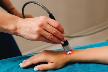 Laser Therapy